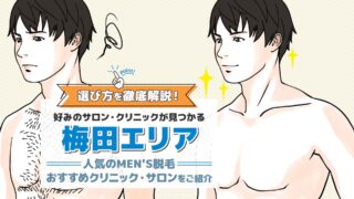 梅田でメンズ脱毛がおすすめのサロン・クリニック5選
