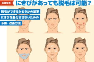 【医師監修】にきびがあっても脱毛できる?悪化予防・改善方法も解説