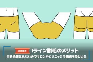 【医師監修】Iライン脱毛とは?痛い?照射範囲や施術方法、期間などをご紹介