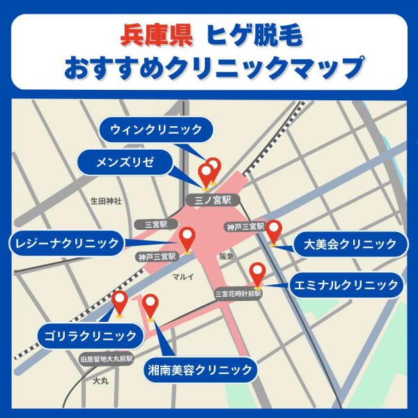 兵庫県メンズ脱毛クリニックマップ