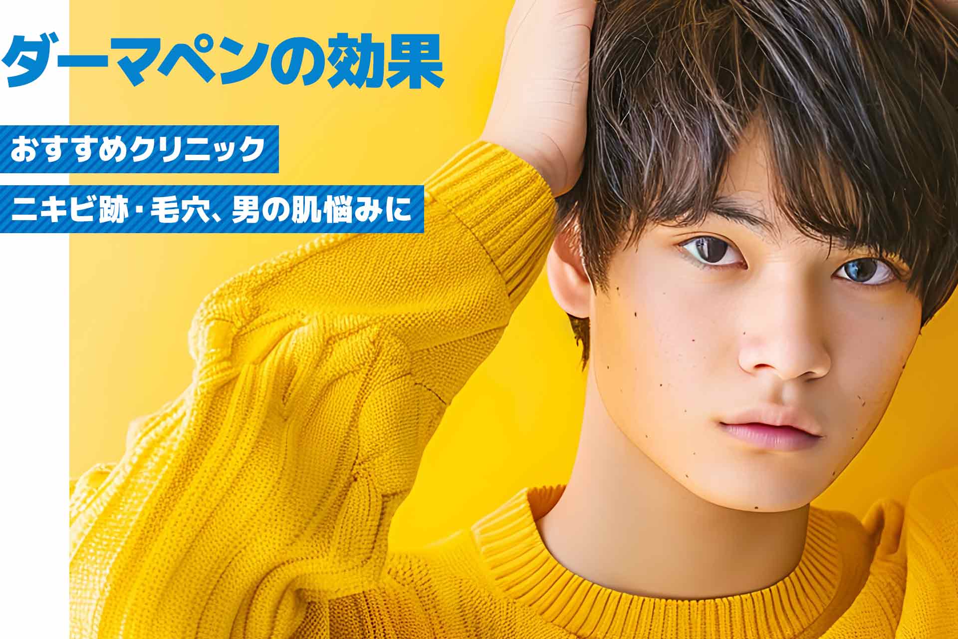 【ニキビ跡・毛穴】男の肌悩みに！ダーマペンの効果とおすすめのクリニックを徹底解説