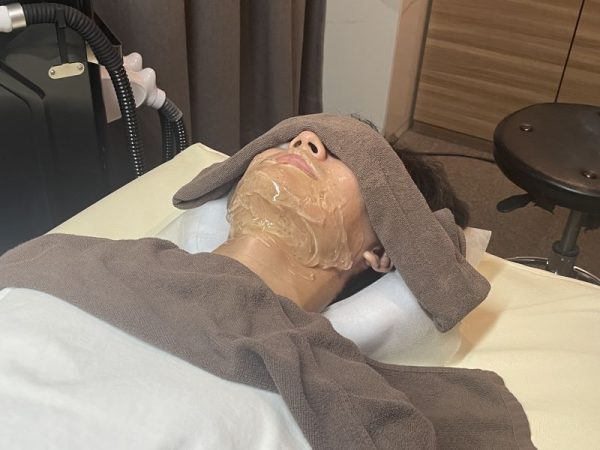 RINXアフターケア