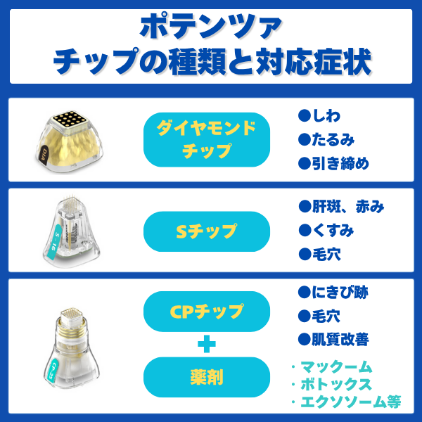 ポテンツァ チップの種類と料金相場 (3)