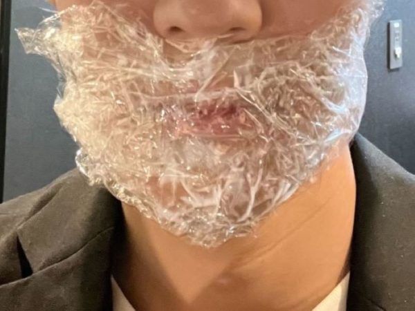 gorilla-clinic_anesthesia