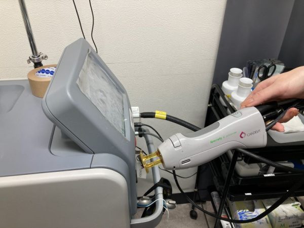 gorilla-clinic_hair-removal-machine