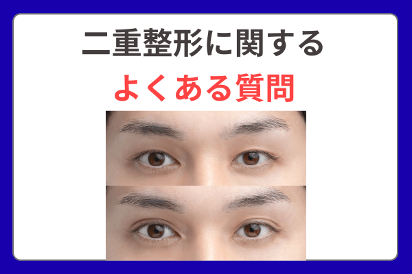 二重整形のよくある質問